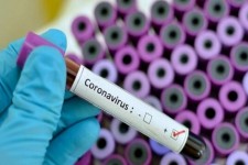 افزایش شمار مبتلایان به کرونا در ایلام به ۶۵۰۰۷ نفر