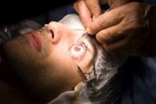 انجام اولین عمل جراحی چشم در دهلران