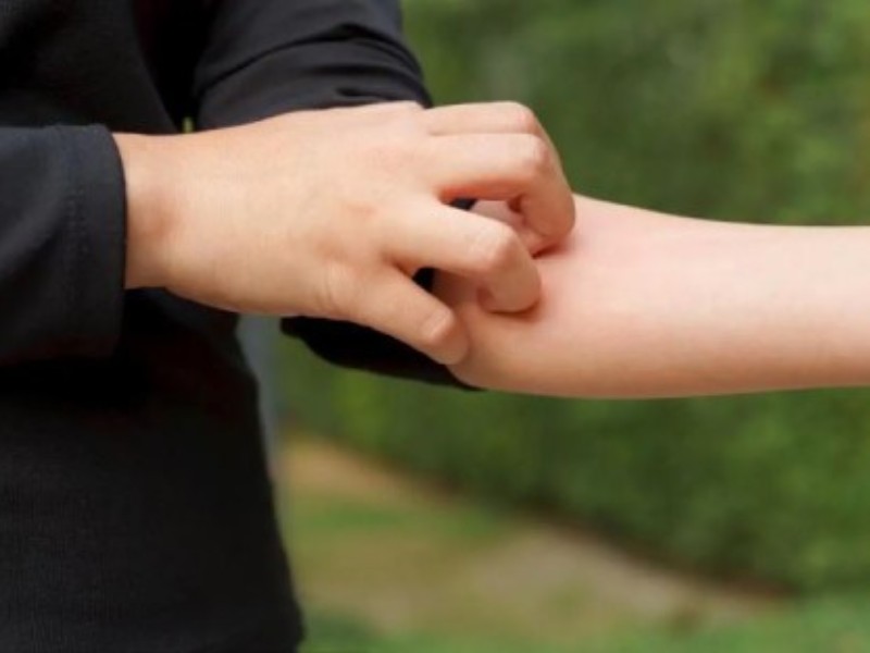 خارش پوست چه موقع خطرناک میشود خارش پوست چه موقع خطرناک میشود