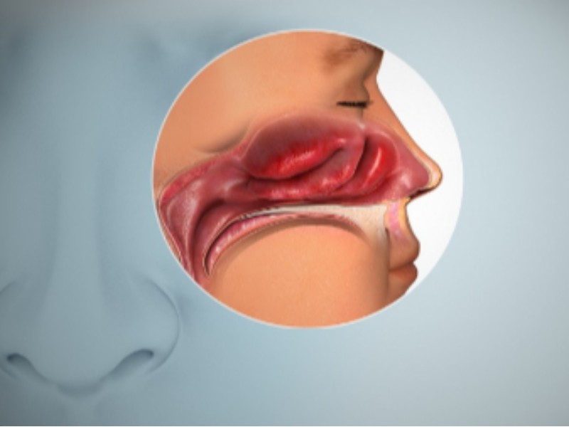 حس بویایی و چشایی بعد از عمل بینی حس بویایی و چشایی بعد از عمل بینی