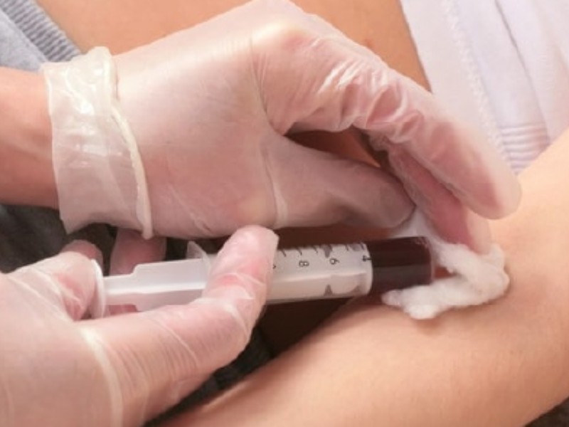 انجام غربالگری رایگان سرطان برای ۲ هزار بانوی ایلامی انجام غربالگری رایگان سرطان برای ۲ هزار بانوی ایلامی